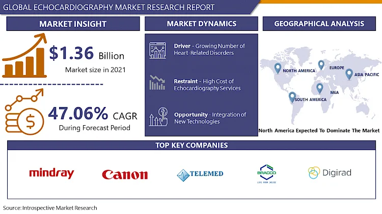 Echocardiography Market Trends, Key Players Analysis, Regional Trends, Competitive Landscape and Industry Potential to 2032