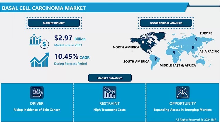 Basal Cell Carcinoma Treatment Market
